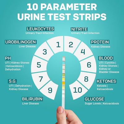 One Step Pet Urine Testing Strips, 100 x 10 Parameter Urinalysis Tests for Dogs, Cats, Vets, Accurate Testing for Veterinarians, Detects UTI, Diabetes, Bladder, Kidney, Liver, SG, pH, Glucose
